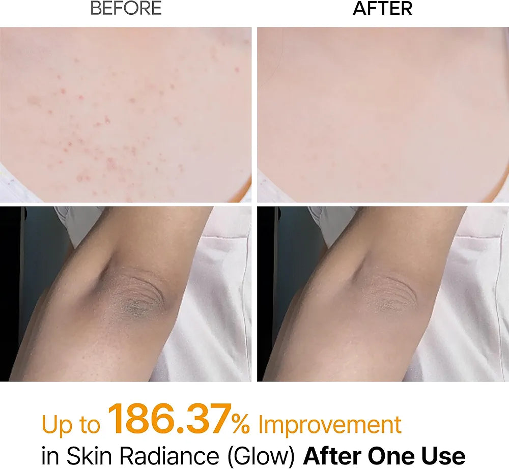 Dr.Melaxin Peel Shot Kojic Acid Turmeric Body Exfoliator Spray in Lebanon