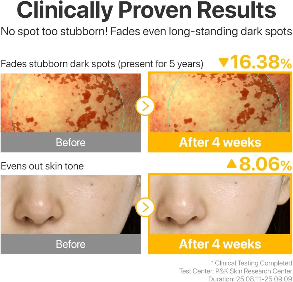 NUMBUZIN No.5 Glutathione TXA Dark Spot Ampoule Korean brightening serum in lebanon