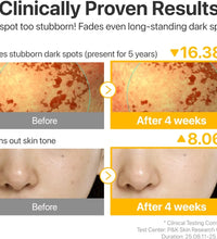 NUMBUZIN No.5 Glutathione TXA Dark Spot Ampoule Korean brightening serum in lebanon