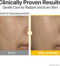 Shop NUMBUZIN No.5+ Vitamin Concentrated Serum in Lebanon. Advanced Korean vitamin serum in lebanon
