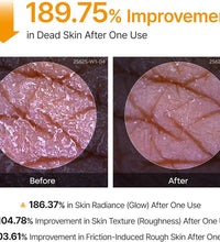 Dr.Melaxin Peel Shot Kojic Acid Turmeric Body Exfoliator Spray in Lebanon