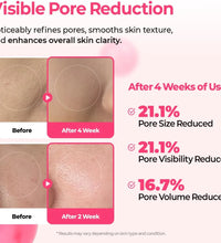 Dr.Melaxin Cyano Pink Spicule Serum in Lebanon