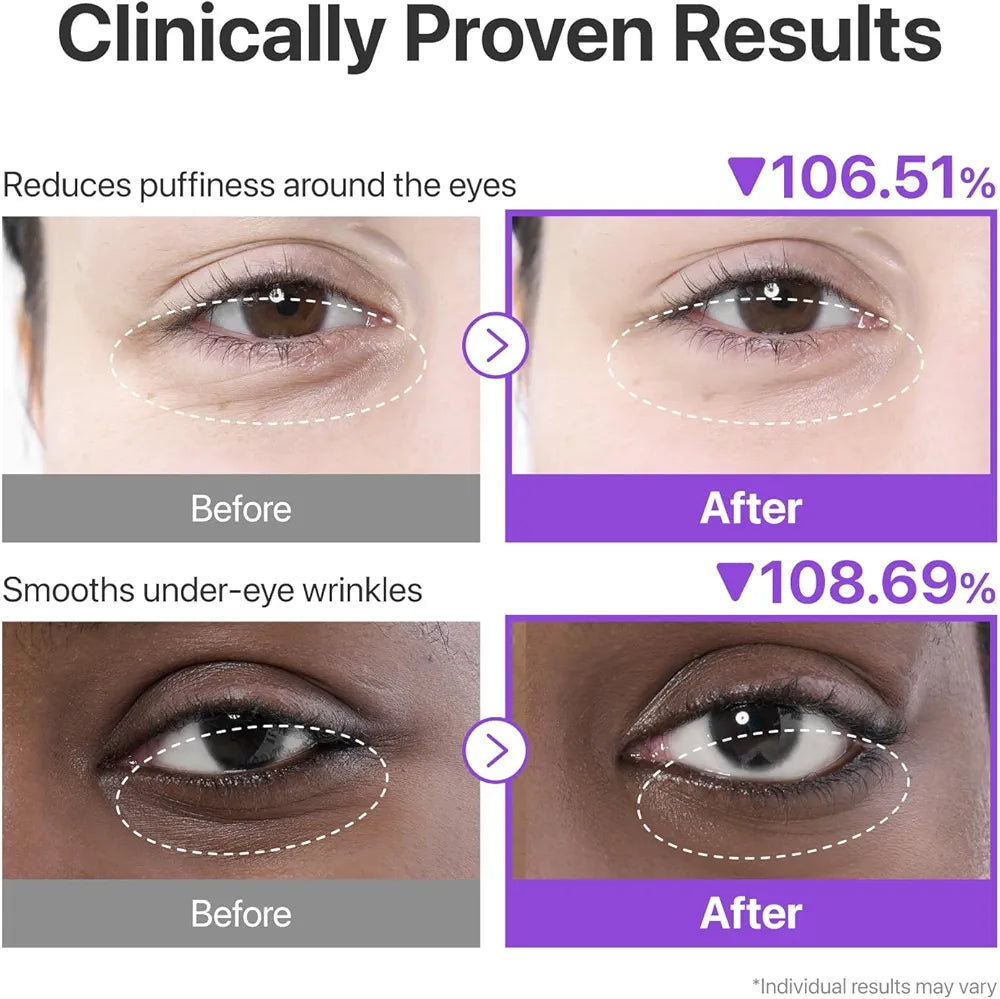 NUMBUZIN No.9 NAD+ Collagen Eye Patches Korean hydrogel eye patches in lebanon