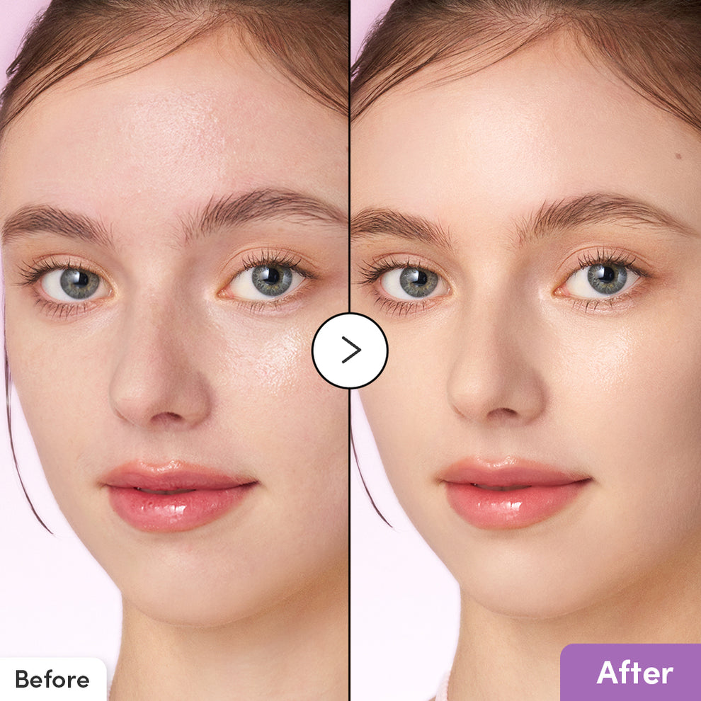 eqqualberry purple pdrn pore minimizing serum lebanon