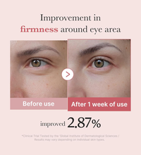 MEDICUBE PDRN Pink Peptide Eye Cream Lebanon Korean anti aging skincare eye cream dark circles