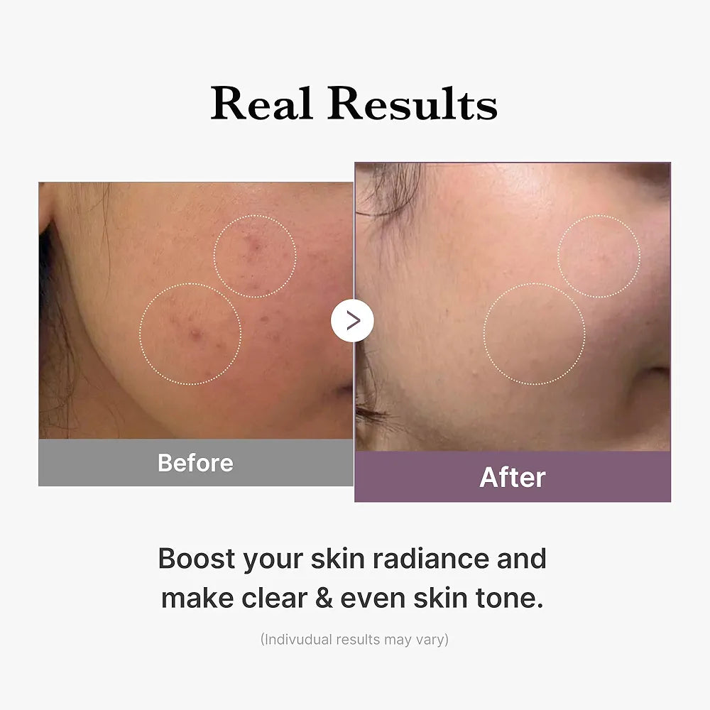 medicube age-r glutathione glow milky toner lebanon