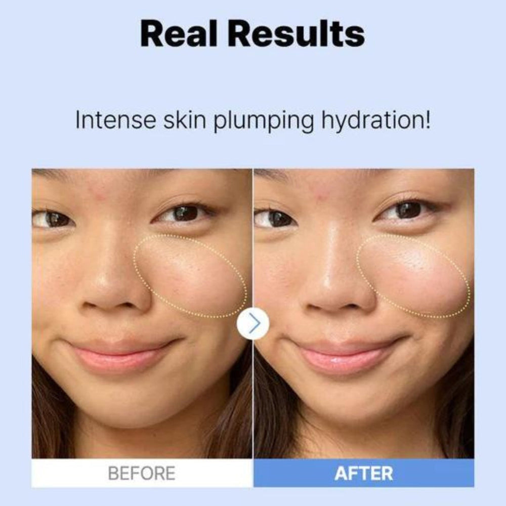 COSRX The Hyaluronic Acid 3 Serum Lebanon Korean hydrating skincare serum plumping